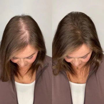 Accélérateur de Croissance des Cheveux