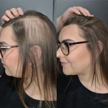 Accélérateur de Croissance des Cheveux