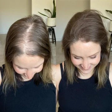 Accélérateur de Croissance des Cheveux