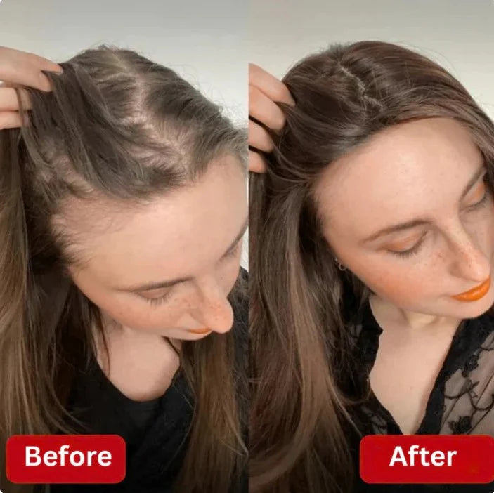 Accélérateur de Croissance des Cheveux